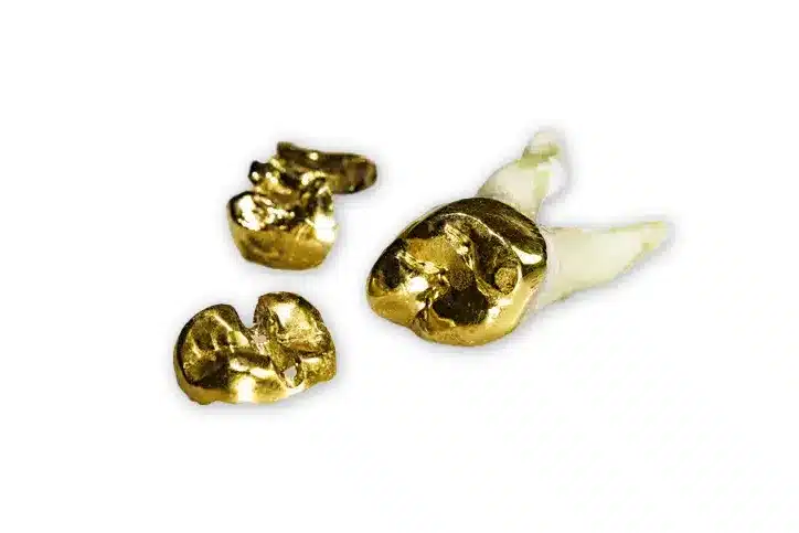 Zahngoldankauf Zahngold